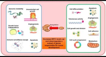 Chieti e Londra unite contro il neuroblastoma pediatrico